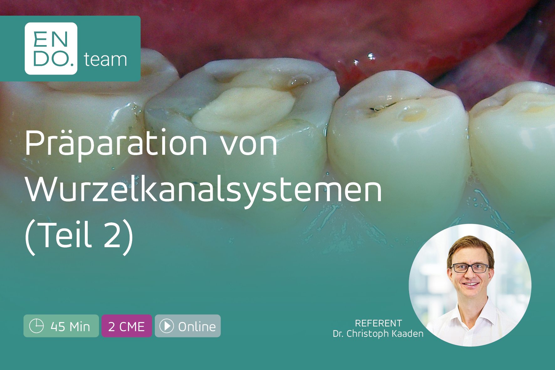 Präparation von Wurzelkanalsystemen - Teil 2