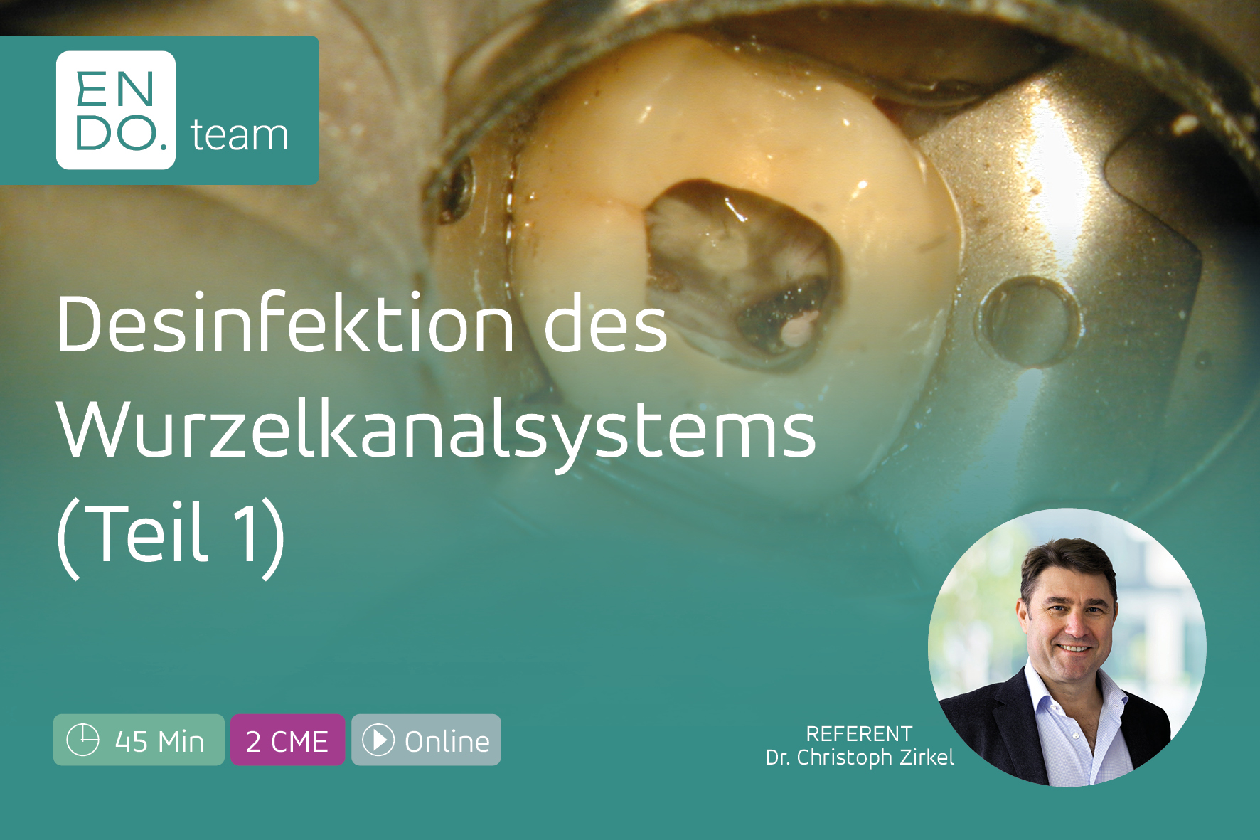 Desinfektion des Wurzelkanalsystems – Teil 1: Bakterien, Biofilm & Smear Layer