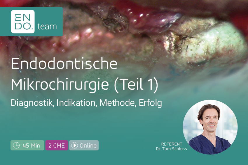 Endodontische Mikrochirurgie - Teil 1