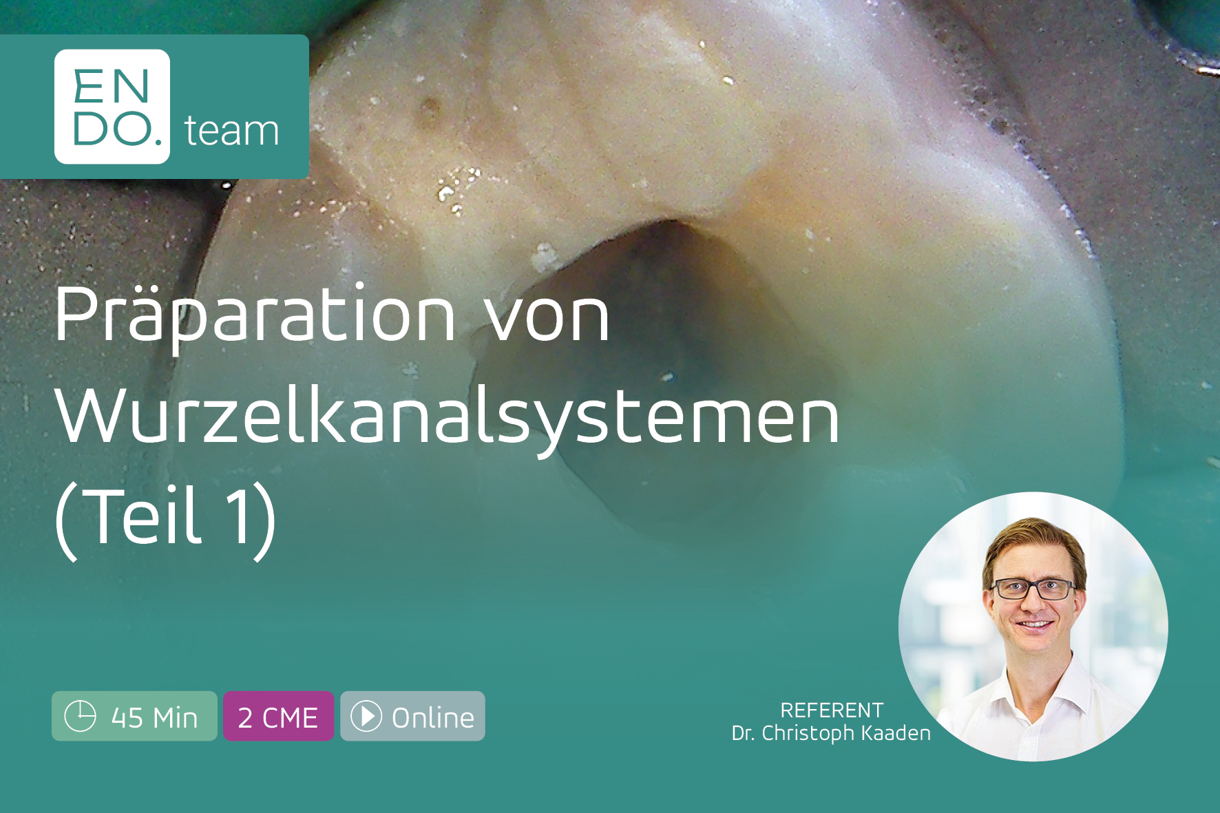 Wurzelkanäle sicher präparieren – Teil 1: Gleitpfad, Instrumentation und Fehlervermeidung