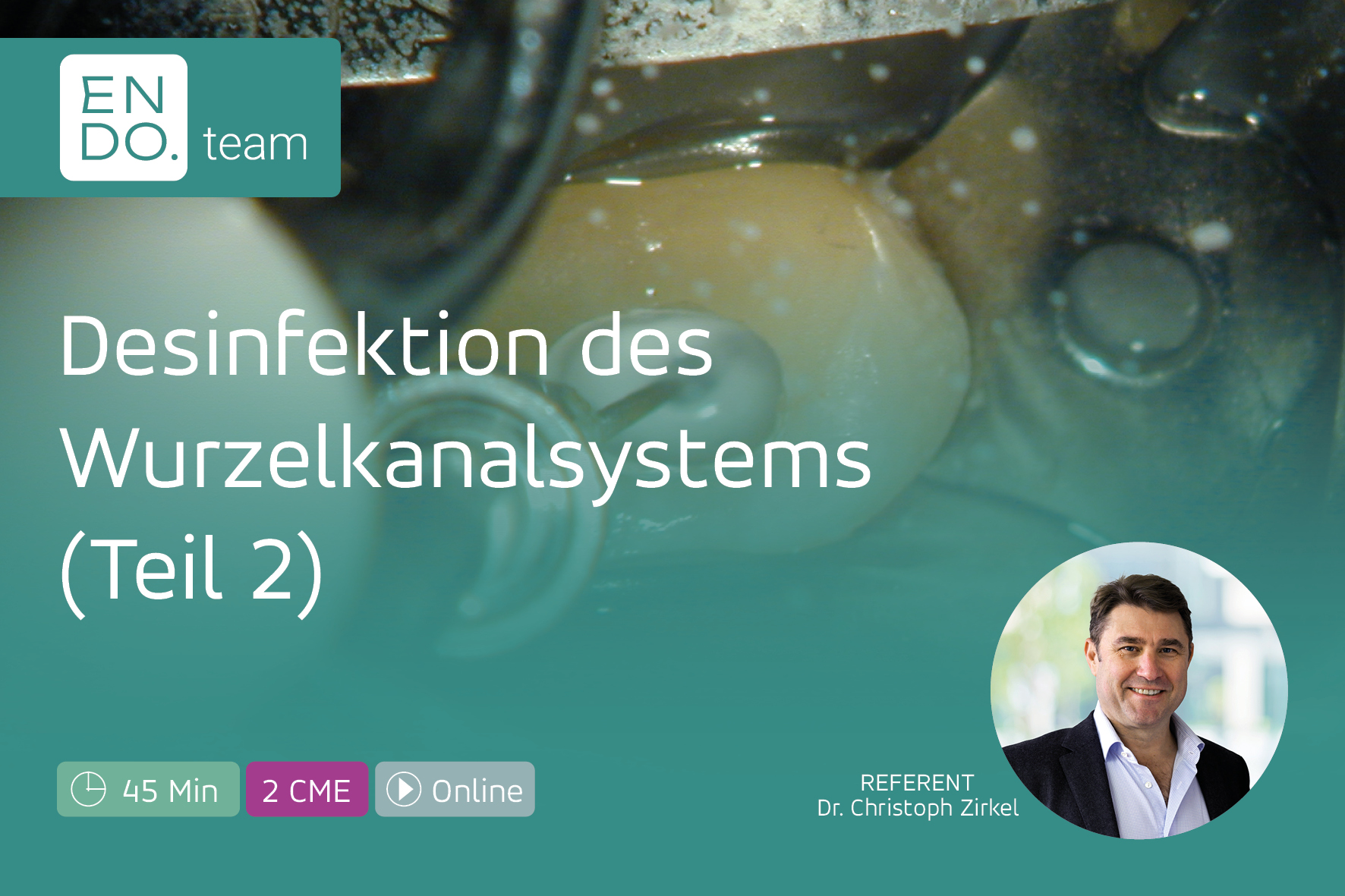 Desinfektion des Wurzelkanalsystems Teil 2 – Spüllösungen, Aktivierung & klinische Anwendung